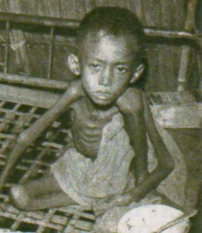 1979 - Hunger in Kambodscha 1979 - Hunger in Kambodscha